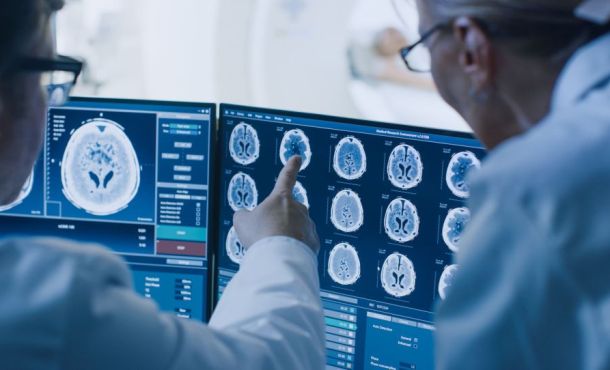 Drogue : quels sont les effets néfastes sur le cerveau ? - L'Etudiant ...